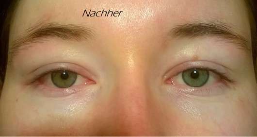 L’ORÉAL PARiS SkinPerfection Anti-Müdigkeit Augenpflege