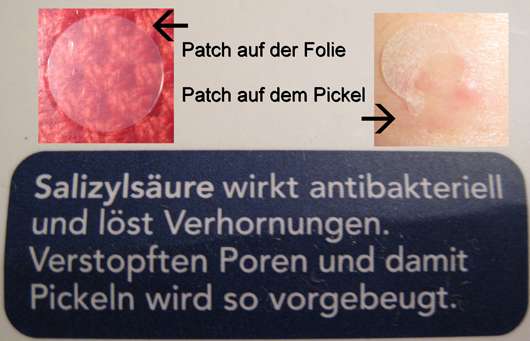 Balea anti pickel patches