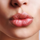 Lippenpflege: Nicht nur im Winter aktuell