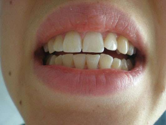 Perlweiss Schönheits Zahnweiss Zahncreme