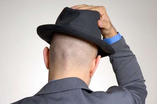 Glatze – macht Männer stark oder unattraktiv?