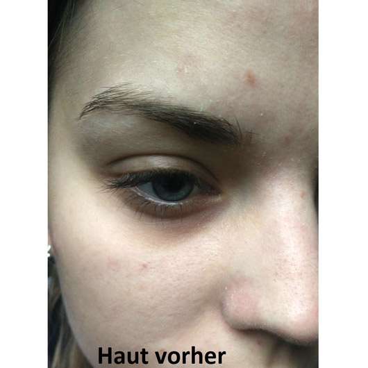 bareMinerals Bare Haven Essential Moisturizing Soft Cream - Hautbild vor der Anwendung