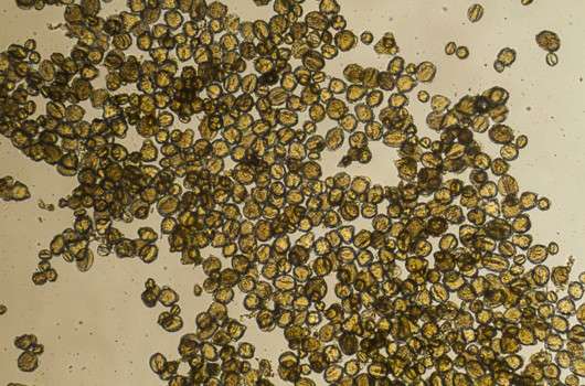 Pollen unter dem Mikroskop betrachtet - ©iStock.com/Videologia