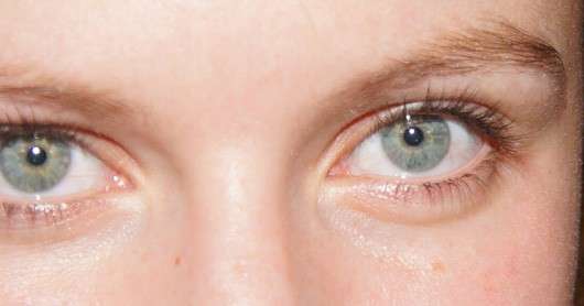 Augenpartie vor Anwendung der Rival de Loop Augen Maske Anti-Aging Pflege