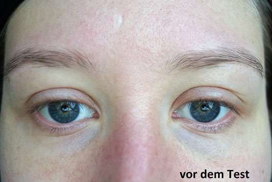 alverde Q10 Augen-Serum Bio-Gojibeere - Haut vor der Testphase
