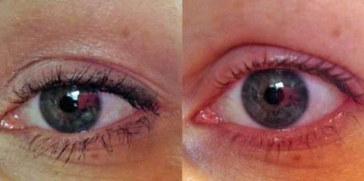 Auge vor und nach Anwendung des Balea Augen Make-up Entferners (ölhaltig) 