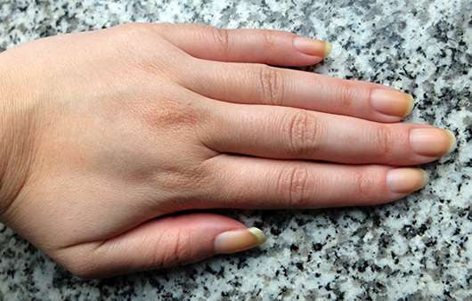 Hände vor der Verwendung der Skineco Ziegenmilchseife mit Honig