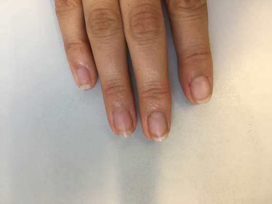 Fingernägel nach Anwendung des Misslyn Care - Care Cocktail 3-Phase Nail Oils