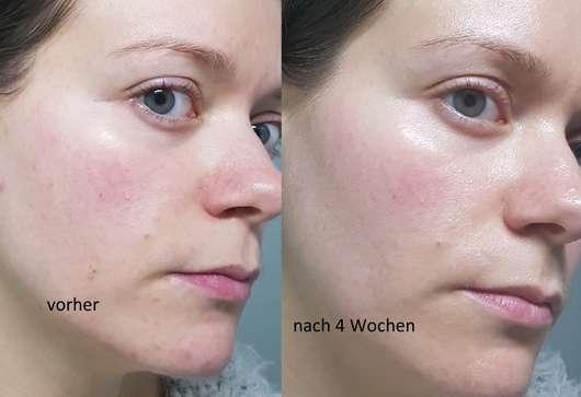 Douglas Perfect Focus Radiance Mask vor und nach der Testphase