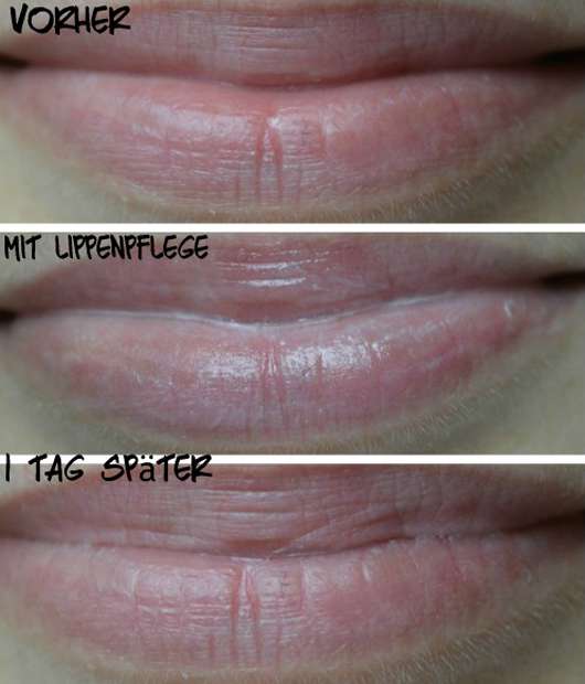 Lippen ohne/mit Blistex Lippenbalsam (Intensive Care)