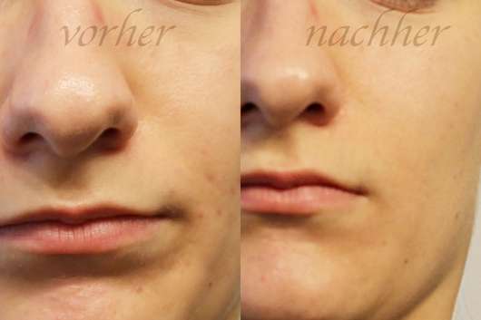 Haut vor/nach dem Test des Lottie London B.A.E. Illuminating Face Primers