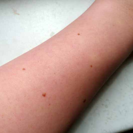 Balea Bodyspray Himbeere Litschi (LE) - Haut nach ca. 5 Minuten