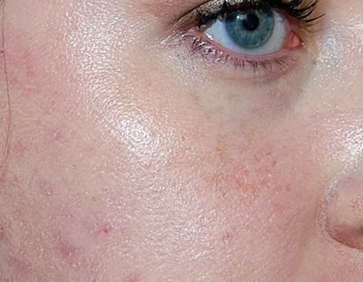 Bourjois Healthy Mix Anti-Fatigue Foundation, Farbe: 51 light vanilla - Gesicht mit Make-up