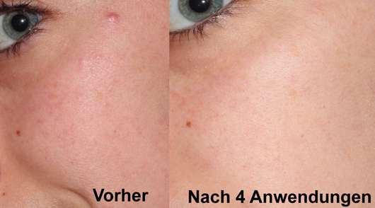 Haut vor/nach dem Test Haut vor/nach dem Test