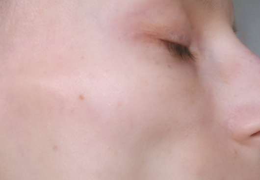 Haut nach der Anwendung der The Beauty Mask Company Motiv-Tuchmaske „Lama“ Haut nach der Anwendung der The Beauty Mask Company Motiv-Tuchmaske „Lama“