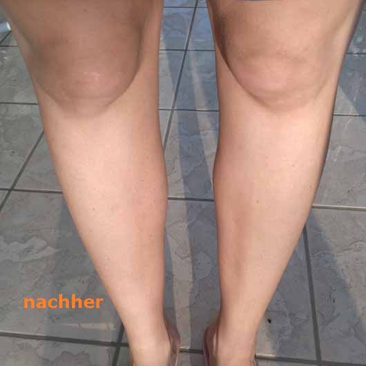 Catrice #InstaShape Slim Legs Body Contour Roller, Farbe: C02 Dark (LE) - Beine nach der Anwendung