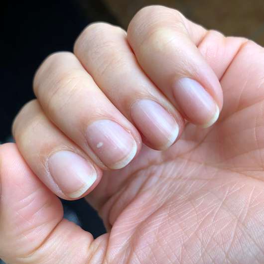 ebelin Nagellackentferner acetonfrei mit Mandelduft - Finger nach der Nagellackentfernung
