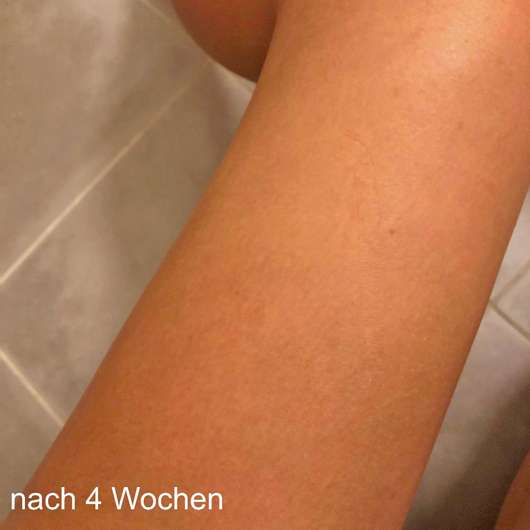 SBC Collagen Skincare Gel - Haut nach 4-wöchigem Test SBC Collagen Skincare Gel - Haut nach 4-wöchigem Test