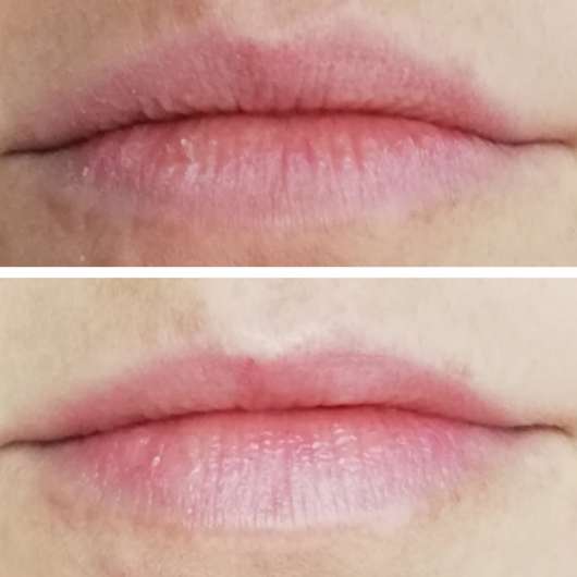 Lippen ohne/mit FOREVER Aloe Lips Lippenpflegestift Lippen ohne/mit FOREVER Aloe Lips Lippenpflegestift