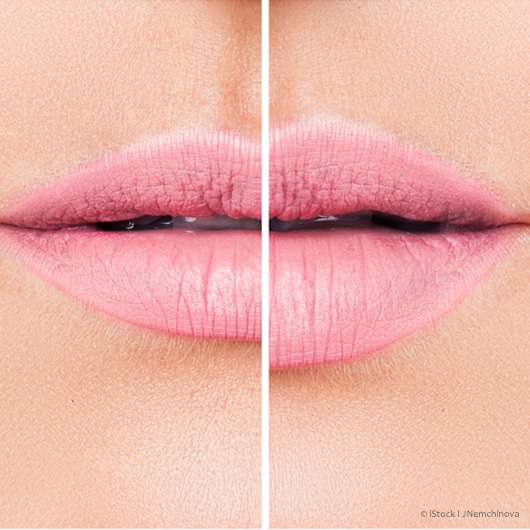 Volle Lippen mit Wow-Effekt – ohne Aufspritzen