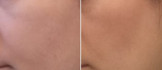 Haut ohne Bronzer (links) // mit Bronzer (rechts) - L.O.V LOVsun Blurring Bronzing Powder, Farbe: 010 Sensual Caramel Haut ohne Bronzer (links) // mit Bronzer (rechts) - L.O.V LOVsun Blurring Bronzing Powder, Farbe: 010 Sensual Caramel