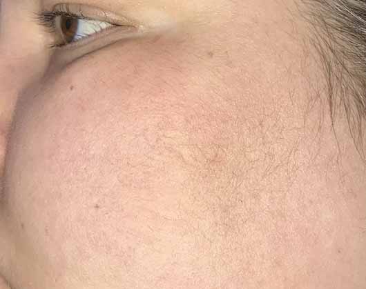 Dr. Jart+ Ceramidin Cream - Haut vor der Anwendung Dr. Jart+ Ceramidin Cream - Haut vor der Anwendung