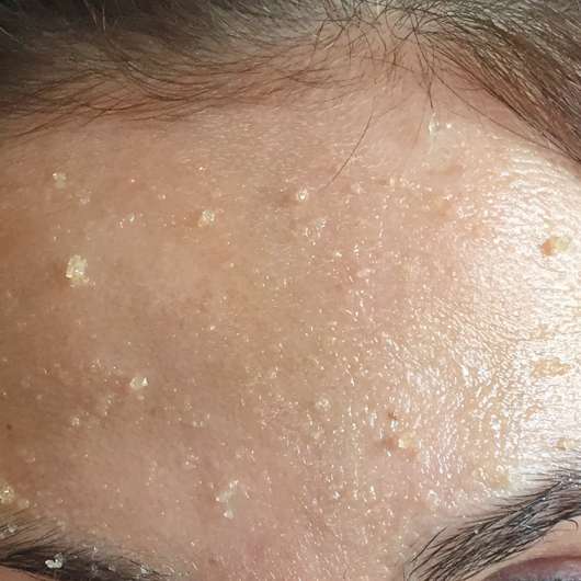 Balea Sugar Scrub (normale und trockene Haut) - Peelingkörner auf der Stirn
