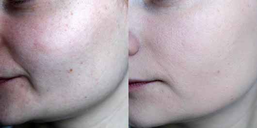 L’ORÉAL PARiS Infaillible 24H Fresh Wear Foundation, Farbe: 15 Porcelaine - links ohne, rechts mit Foundation L’ORÉAL PARiS Infaillible 24H Fresh Wear Foundation, Farbe: 15 Porcelaine - links ohne, rechts mit Foundation