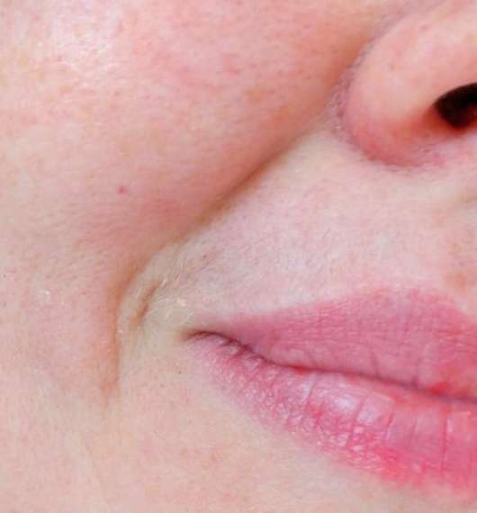 Haare vor der Anwendung der XYO Rapid Haar-Bleichcreme Haare vor der Anwendung der XYO Rapid Haar-Bleichcreme