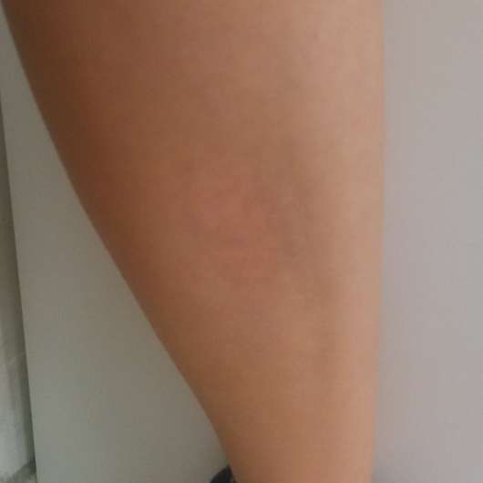 Haut nach 2 Tagen Haut nach 2 Tagen
