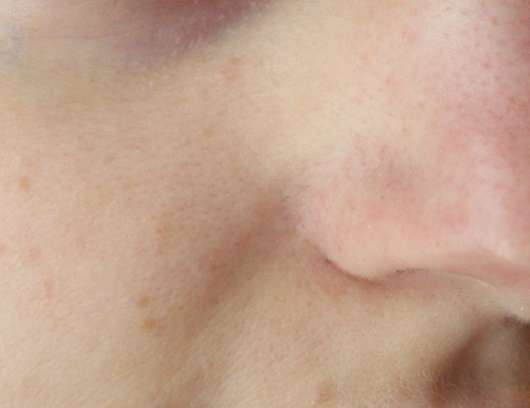 Haut mit Pore Filler Base