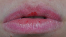Lippen nach dem Abschminken des t trend IT UP Color Lip Tint, Farbe: 020
