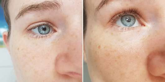 links: Augenpartie zu Testbeginn // rechts: Augenpartie nach 4 Wochen (Schwellungen sind weg, der Blick erfrischt) links: Augenpartie zu Testbeginn // rechts: Augenpartie nach 4 Wochen (Schwellungen sind weg, der Blick erfrischt)