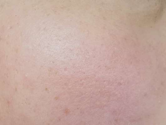 Ebenmäßiger Hautton nach Auftrag des Abdeckstiftes von Alterra Ebenmäßiger Hautton nach Auftrag des Abdeckstiftes von Alterra