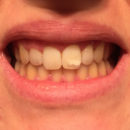 Mara Expert Aktivkohle Intensiv Zahnpflege-Jelly