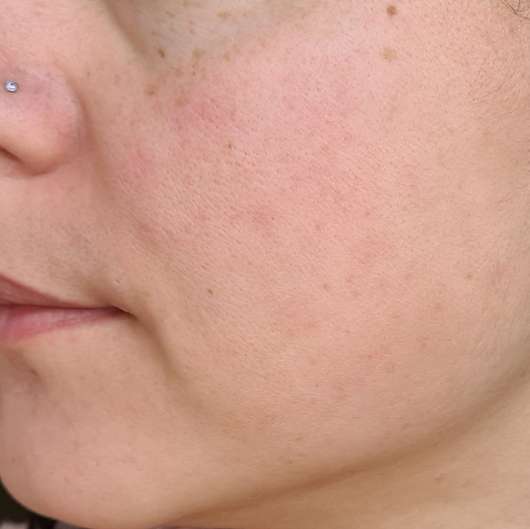 Alterra Naturkosmetik Hyaluron-Spray - nach dem Test Alterra Naturkosmetik Hyaluron-Spray - nach dem Test
