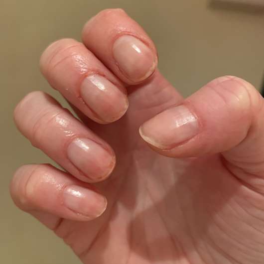 Fingernägel nach der Anwendung des essence Repair Nail Oil "Nails & Cuticles Nourisher"