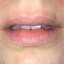 Lippen ohne Kneipp Lippenpflege Sinnlich (Holunder Kartité)