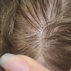 The herbary Saure Rinse Haartee-Spülung - Rückstände auf der Kopfhaut