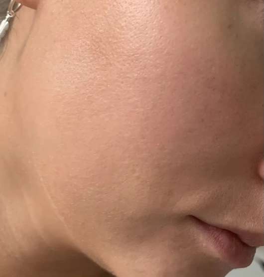Haut mit Schaebens Perfect Skin Beauty Konzentrat