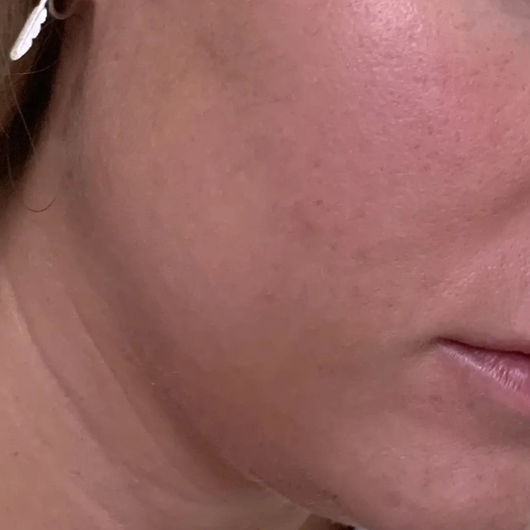 Pixi Retinol Tonic Pixi Retinol Tonic