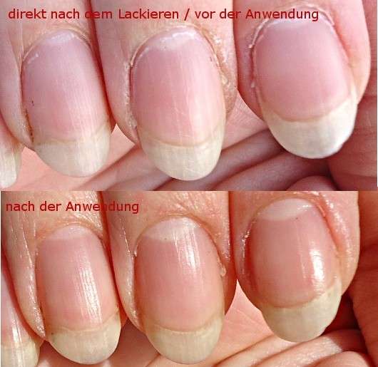 essence studio nails nail cuticle remover pen 