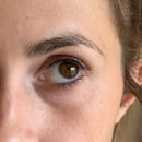 Augenpartie nach dem Test der Hollywood Skin Eye Patches Hyaluron Augenpatches