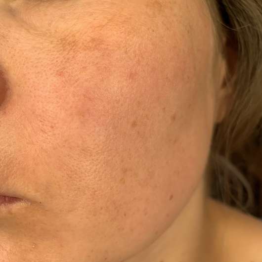 Haut zu Testbeginn - Tiroler Kräuterhof Naturkosmetik Bio Gesichtscreme